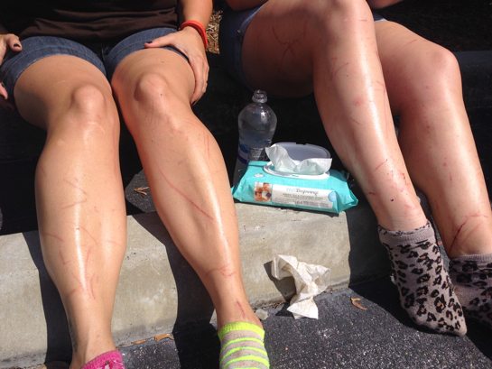 Poison Ivy Legs  Injured Bobcat Rescued &#8211; Euthanized PoisonIvyLegs2